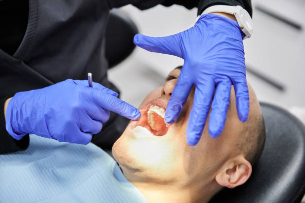 Best Emergency Treatment for Oral Infections in Burns Flat, OK